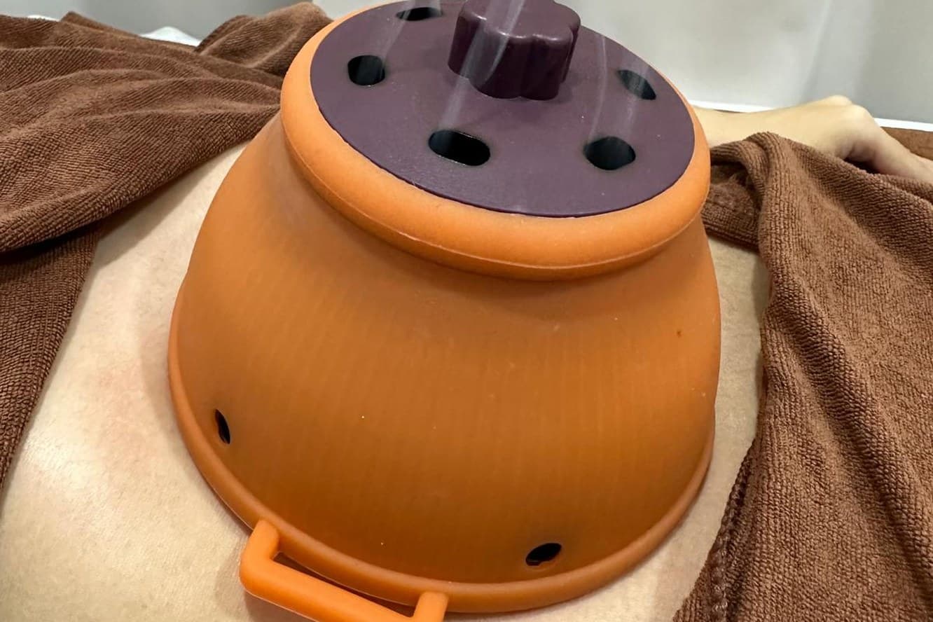 A vented ceramic moxa box resting on a patient's abdomen, draped with towels.